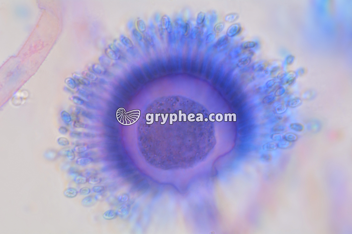 Aspergillus niger - conidiophore et formation des spores x400 - gryphea.org